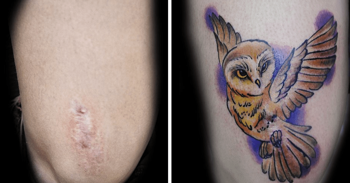 Deze vrouwen schamen zich voor hun littekens dus ze maken er prachtige gratis tattoos van