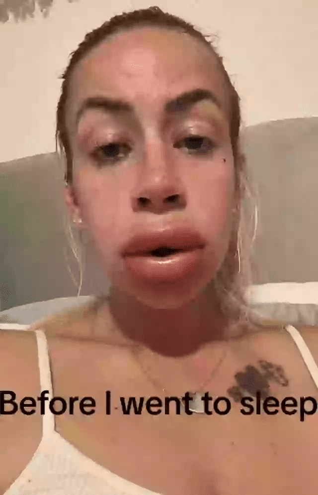 lippen